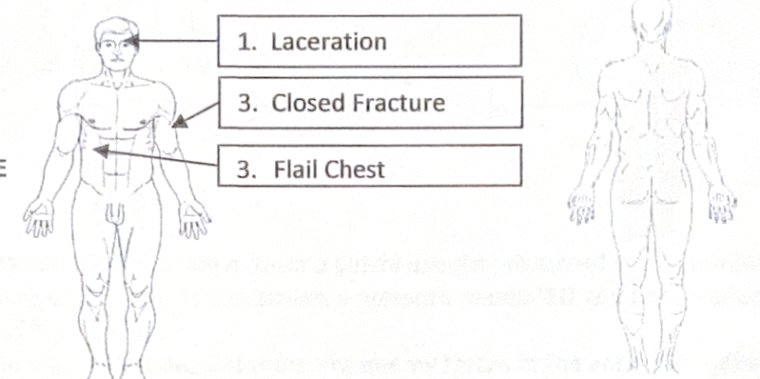 Scenario 15 injury diagram