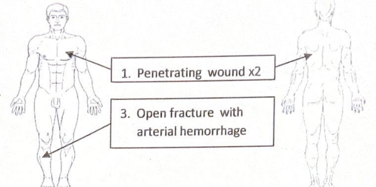 Scenario 3 injury diagram