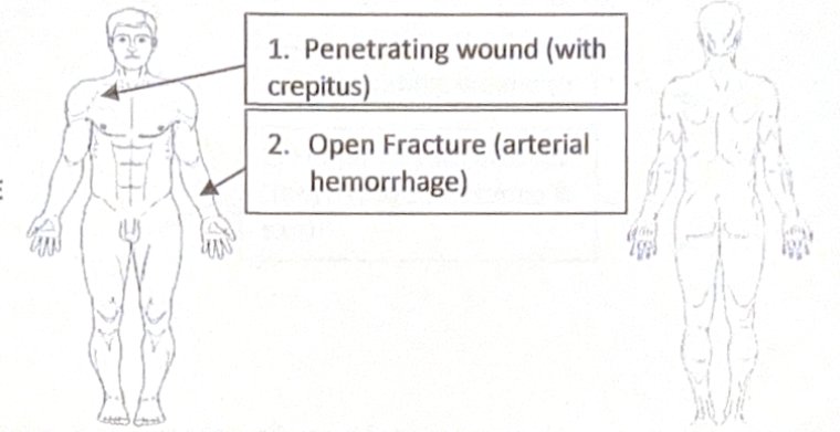 Scenario 18 injury diagram