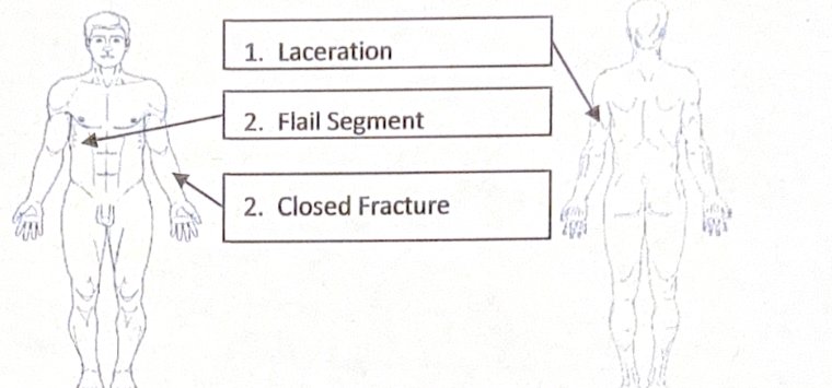 Scenario 4 injury diagram