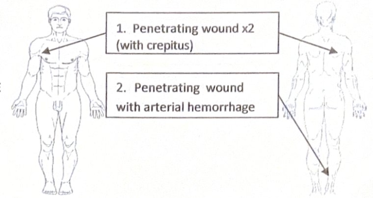Scenario 28 injury diagram