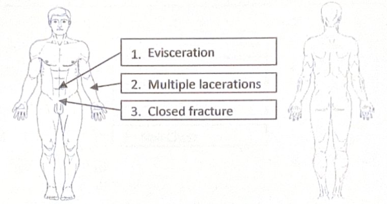 Scenario 14 injury diagram