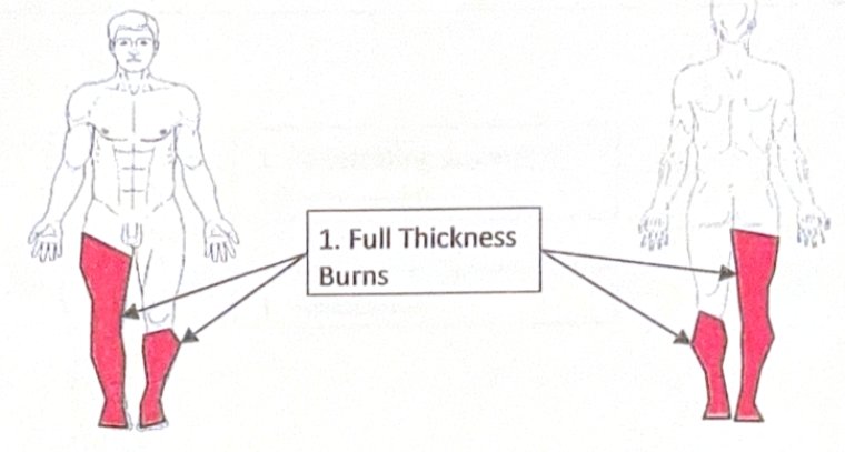 Scenario 30 injury diagram