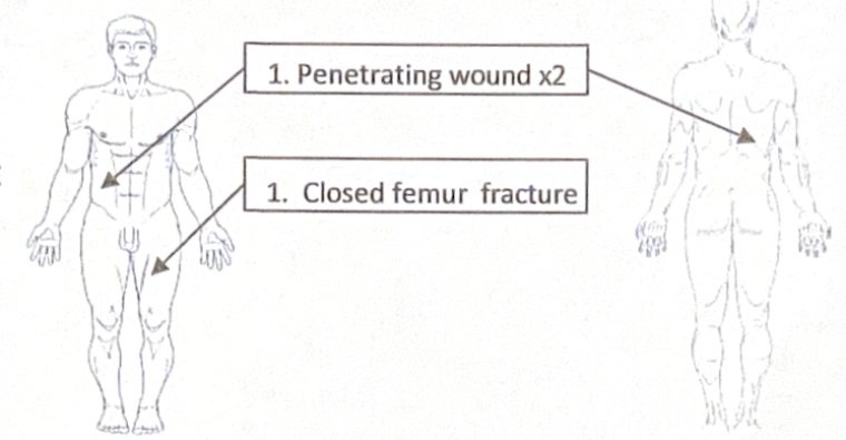 Scenario 36 injury diagram