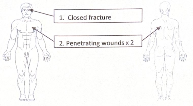 Scenario 11 injury diagram