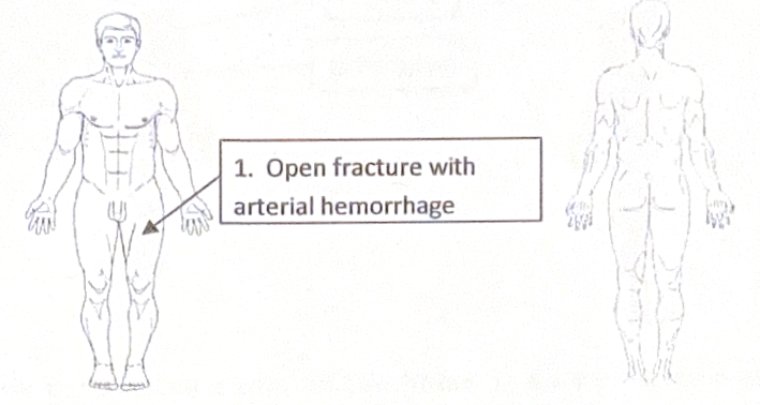 Scenario 32 injury diagram