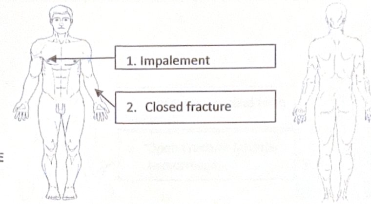 Scenario 17 injury diagram
