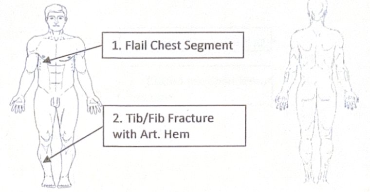 Scenario 23 injury diagram
