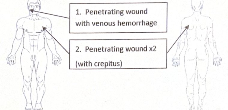 Scenario 5 injury diagram