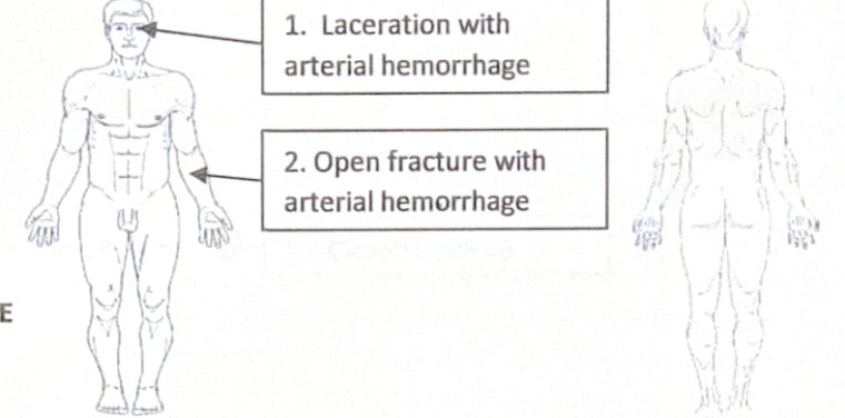 Scenario 25 injury diagram