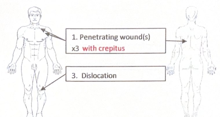 Scenario 31 injury diagram