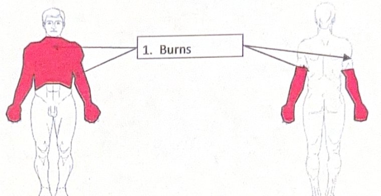 Scenario 10 injury diagram