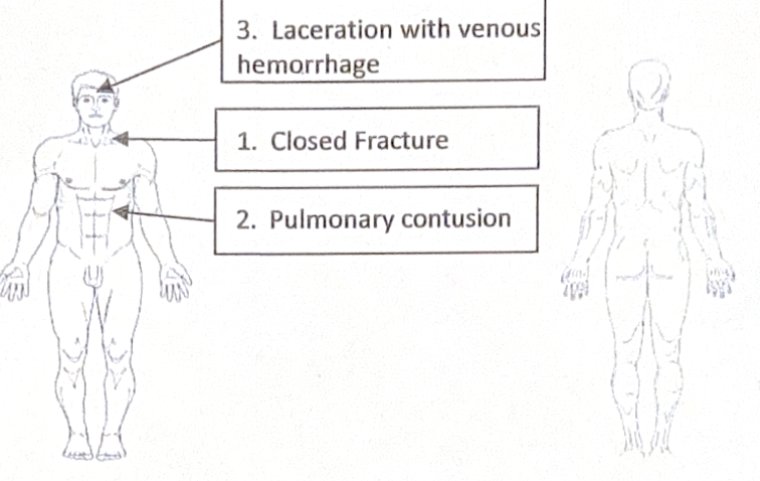 Scenario 20 injury diagram