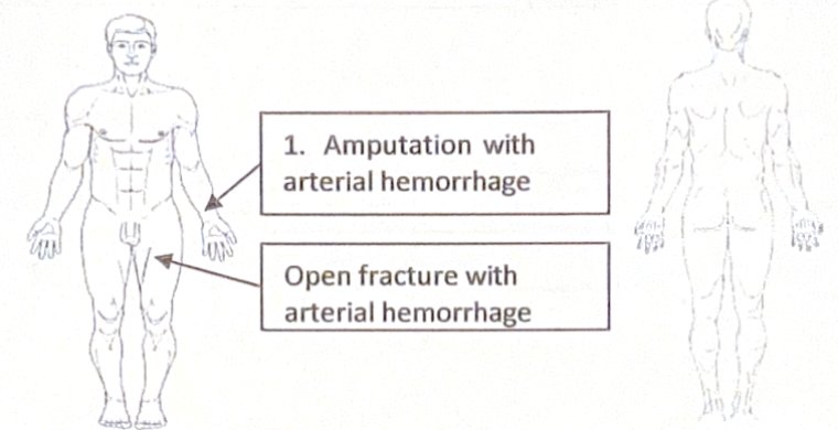 Scenario 13 injury diagram