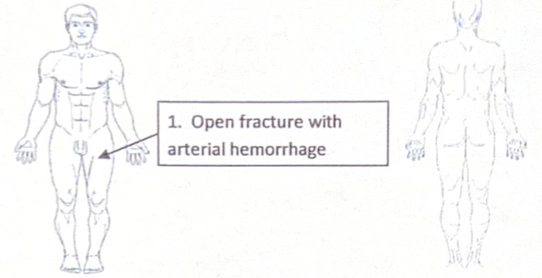 Scenario 1 injury diagram