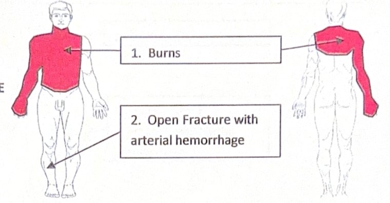 Scenario 21 injury diagram
