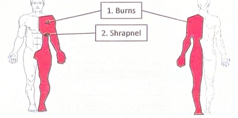 Scenario 35 injury diagram