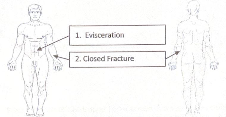 Scenario 29 injury diagram