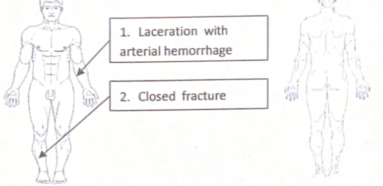 Scenario 6 injury diagram