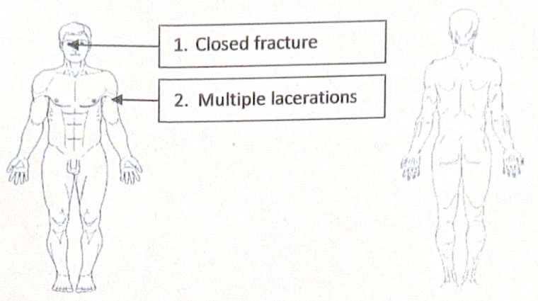 Scenario 9 injury diagram