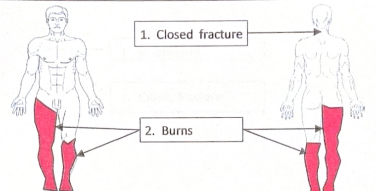 Scenario 16 injury diagram