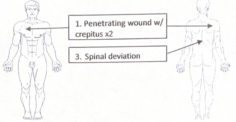 Scenario 7 injury diagram