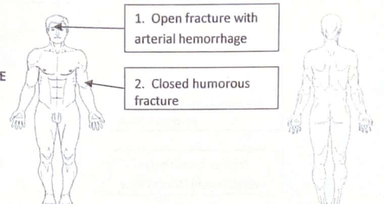 Scenario 27 injury diagram