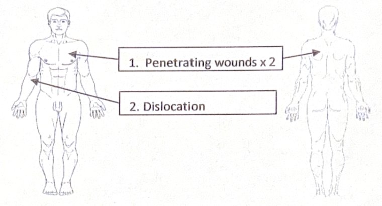 Scenario 12 injury diagram