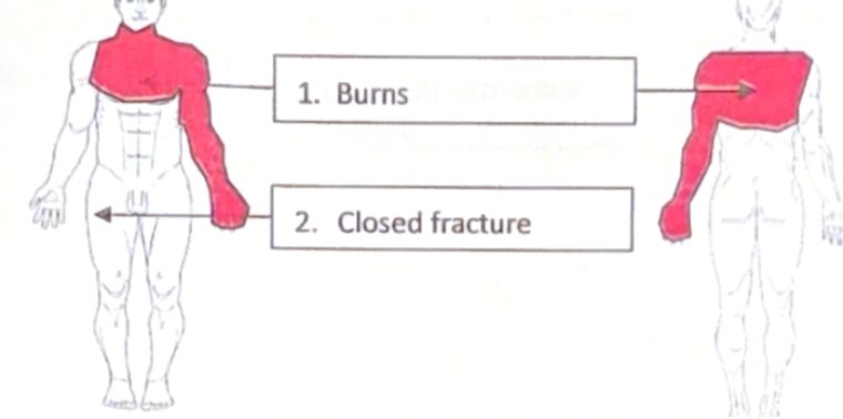 Scenario 26 injury diagram