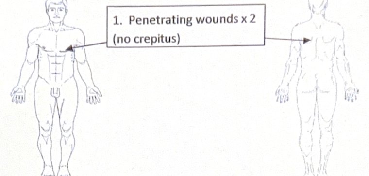 Scenario 2 injury diagram